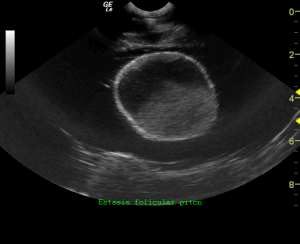 ecografía exóticos