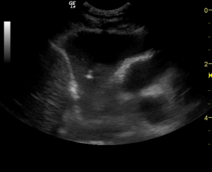 eco intervencionista