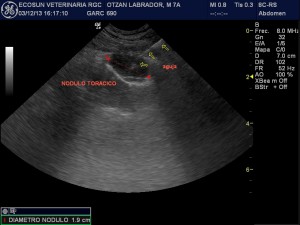 eco torácica no cardíaca